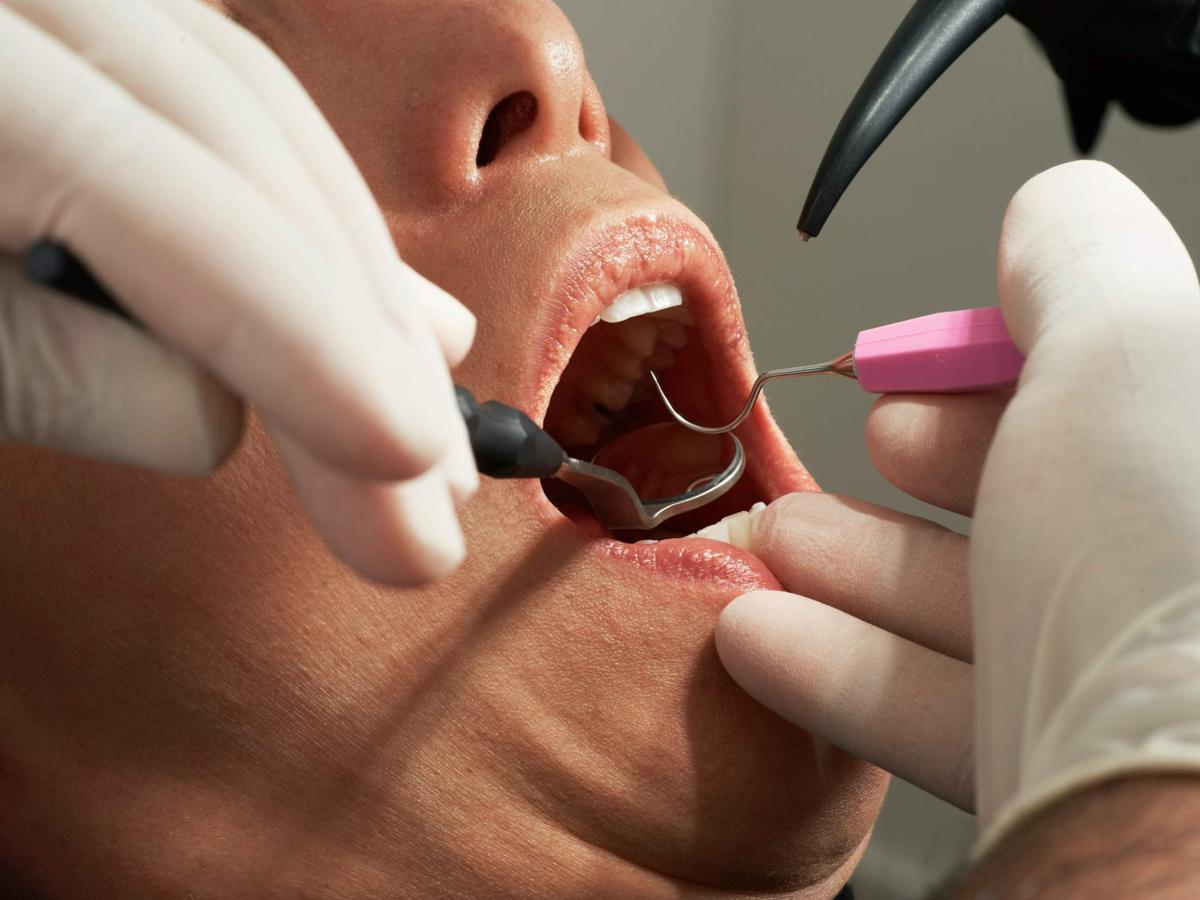 Dentist examining a patient's teeth with a mirror and probe